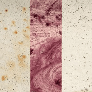 An image of the Before / During and after use of Azpects EASYCare EASY4Rust 500ml and how it removed rust from stone